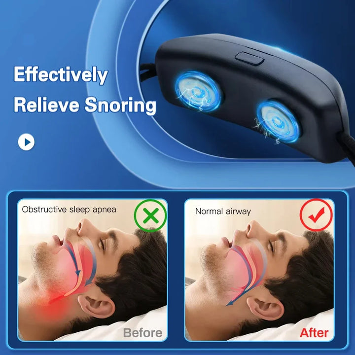 Anti-Snoring Sleep Device